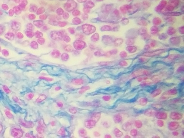 Reticular Connective Slides - Reticular Connective 12 400X